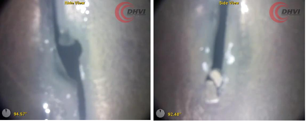 DHVI Case Study - Leak Detection Side View Images
